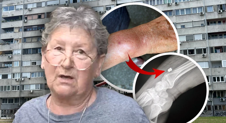 (VIDEO) "Čula sam pucanj, a onda sam osjetila bol" Baka (72) preplašena, napadač još nije pronađen