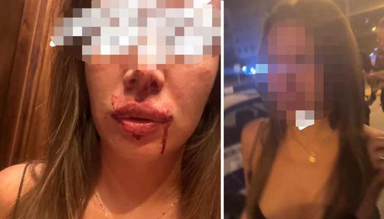 (VIDEO, FOTO) Šutirao, čupao za kosu, vukao po lokalu: Muškarac koji je na JEZIV NAČIN tukao djevojku u restoranu PUŠTEN NA SLOBODU