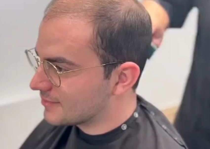 Frizer transformisao proćelavog mladića