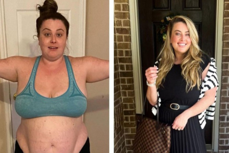 "Zvali su me NASUKANI KIT" Žena imala 138 kilograma, a nakon bezbroj uvreda odlučila da smrša i promijeni svoj život iz korijena