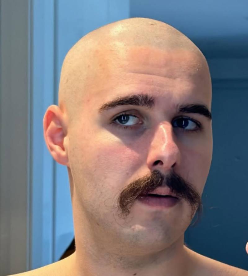 Reper Pljugica