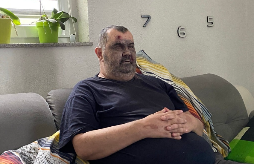 Šimun Žilić treba NAŠU POMOĆ: Prije 10 godina DOŽIVIO TRAGEDIJU koja mu je promijenila život