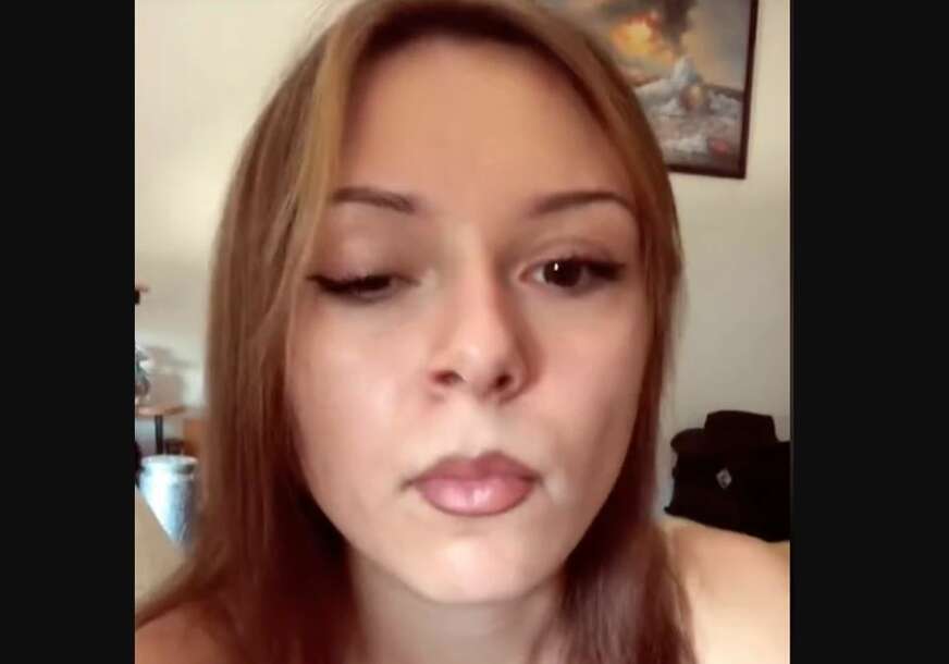 Paraliza lica 