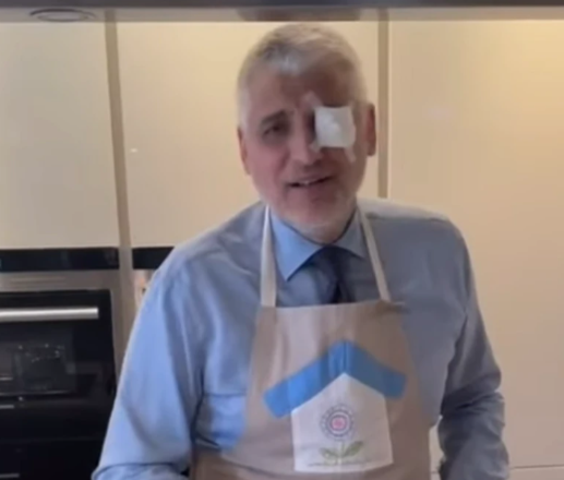 ČEDA JOVANOVIĆ POVRIJEDIO OKO Političar zabrinuo pratioce objavom
