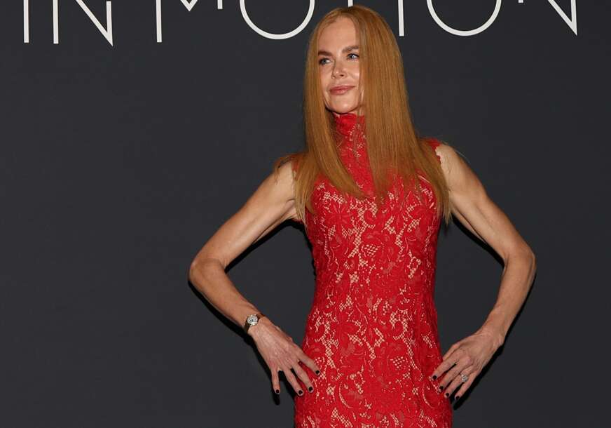 Gaf na festivalu u Kanu: Nikol Kidman objasnila zašto NOSI PERIKU