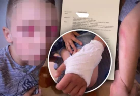 (FOTO) "PLAŠI SE DJECE, ISPISAĆU SINA IZ ŠKOLE” Dječaka (7) vršnjak gurnuo niz stepenice, ima epi napade, njegova majka zabrinuta