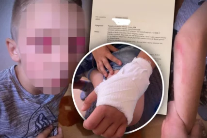Dječaka vršnjak gurnuo niz stepenice
