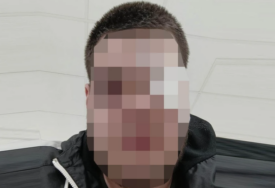 Ovo je pretučeni učenik: Tinejdžeru POLOMLJENA JAGODIČNA KOST, sa povredama primljen u bolnicu