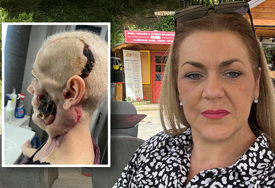 (FOTO) Boluje od AGRESIVNOG RAKA usne šupljine: Za samo 12 sati prikupljena sredstva za liječenje Medise Delić