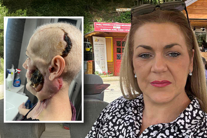 (FOTO) Boluje od AGRESIVNOG RAKA usne šupljine: Za samo 12 sati prikupljena sredstva za liječenje Medise Delić