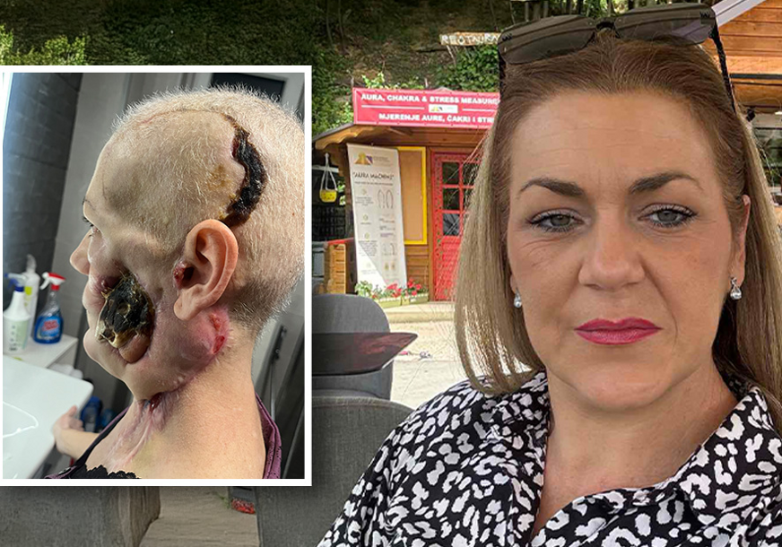 (FOTO) Boluje od AGRESIVNOG RAKA usne šupljine: Za samo 12 sati prikupljena sredstva za liječenje Medise Delić