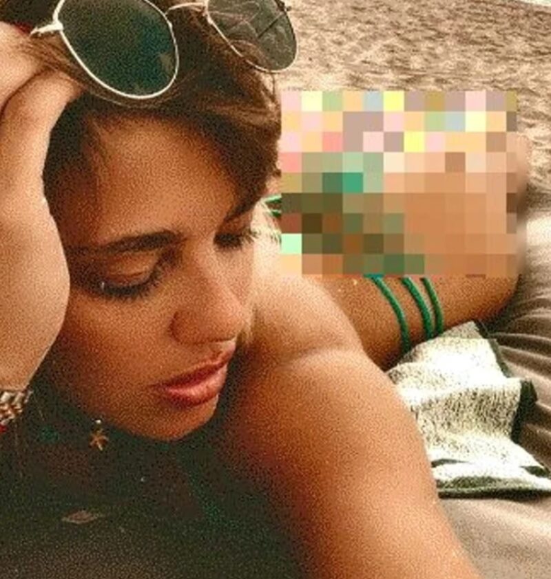 FOTO: