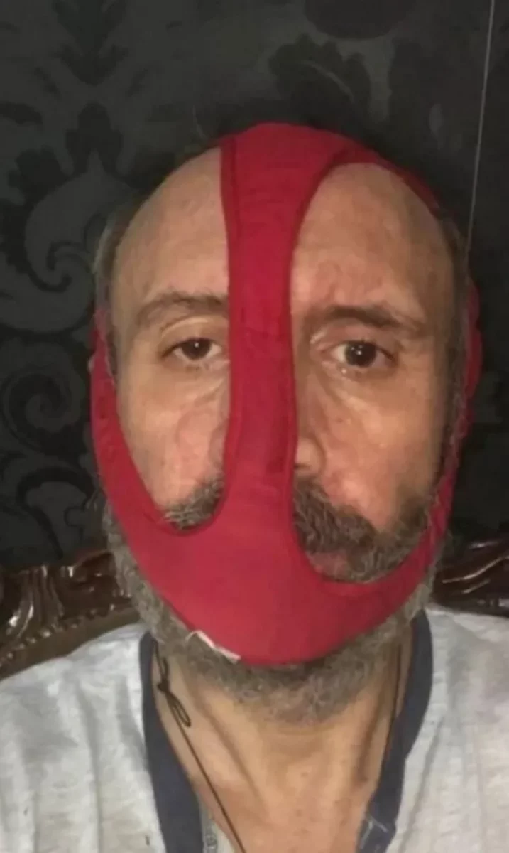 Fotos Pistađis