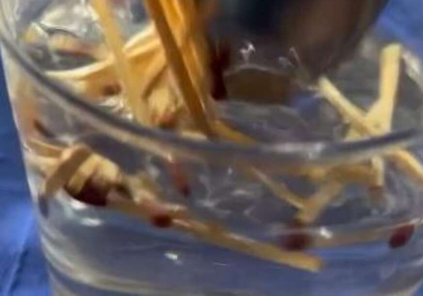 (VIDEO) “METODA KOJA POMAŽE” Ubacila je šibice u vodu, primjetila je razliku kod sobnog cvijeća