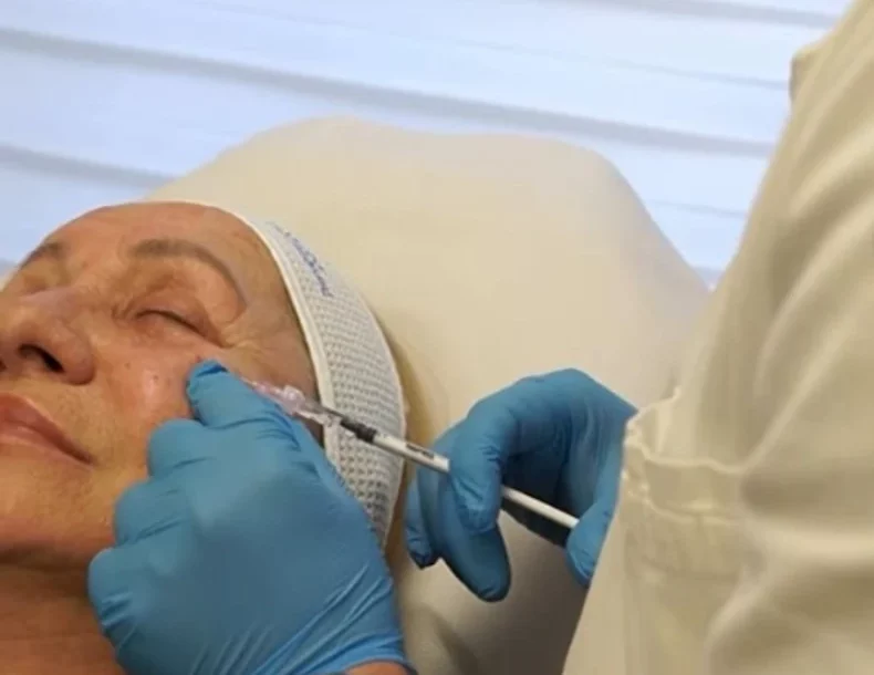 “IZGLEDA BAR 15 GODINA MLAĐE” Vesna Zmijanac (68) uradila estetsku korekciju, ISPEGLALA BORE i dobila novo lice