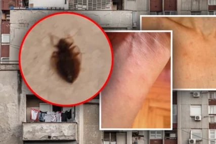 Posljedice ujeda ovog insekta mogu biti paklene: Koji su simptomi znak da morate hitno kod ljekara