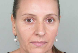 (FOTO) Od žene ni traga ni glasa: Nestala Ružica Nedinić iz Dervente, policija i porodica mole za pomoć