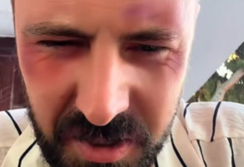 (VIDEO) "Treba mi pomoć, nije mi dobro" Pjevač POKAZAO LICE U PODLIVIMA, tvrdi da ga je napalo i pretuklo 5 muškaraca