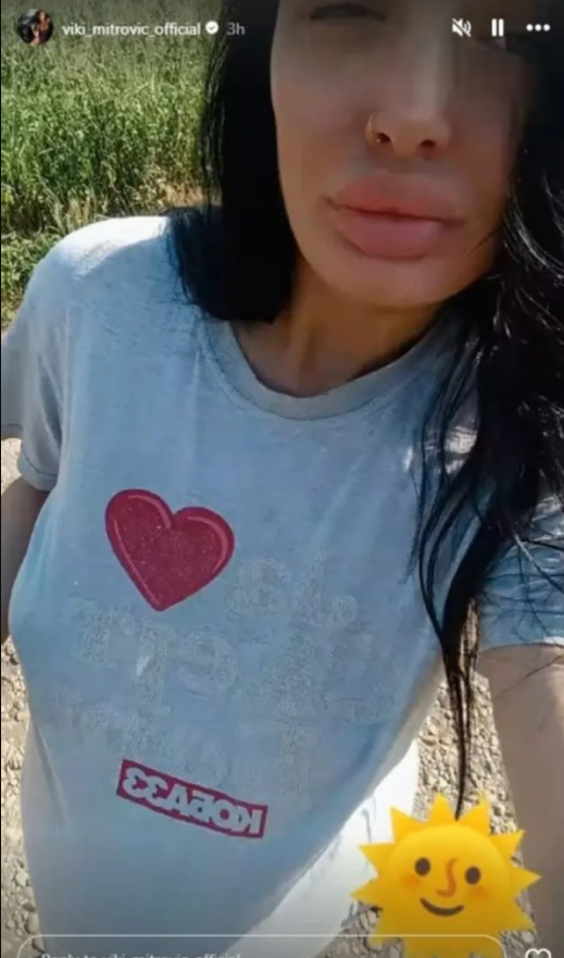 FOTO: