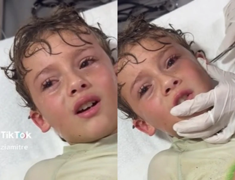 (VIDEO) "HOĆU LI OSTATI GLUV" Dječaku na plaži nešto ušlo u uho, a onda su mu ljekari izvadili ovo