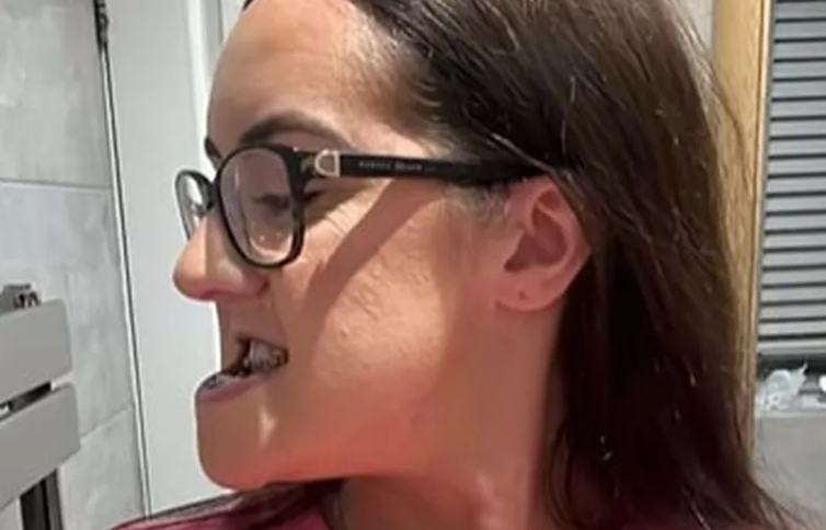 (VIDEO) Luiza postigla POTPUNU TRANSFORMACIJU "Boljelo je, ali sam se tješila činjenicom da će operacija jednog dana sve promijeniti"