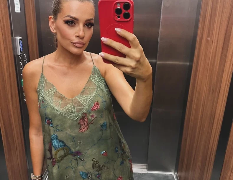 "To je moj problem" Jelena Kostov otkrila da li je radila estetske korekcije na licu