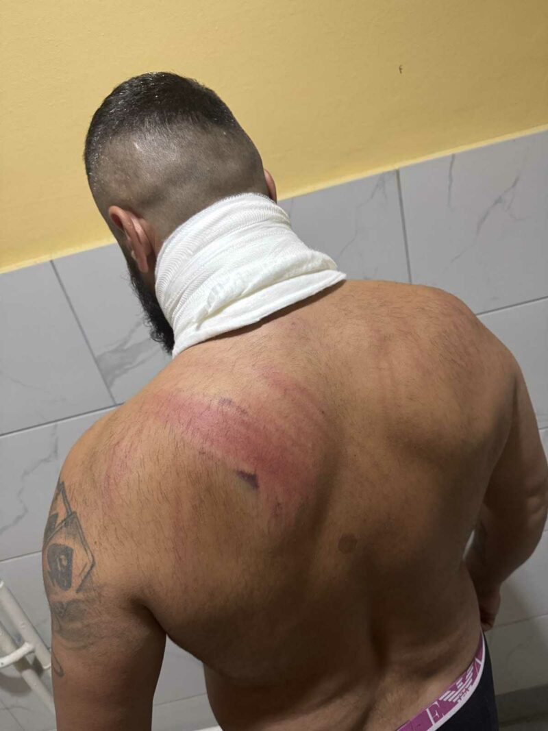 pretučen u policijskoj stanici Zarko Babic