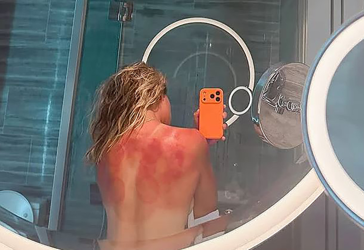 Renata Zarazua doživjela peh pred početak Australijan opena