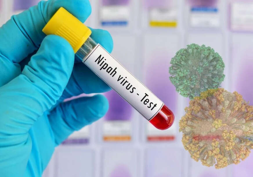 Virus Nipah