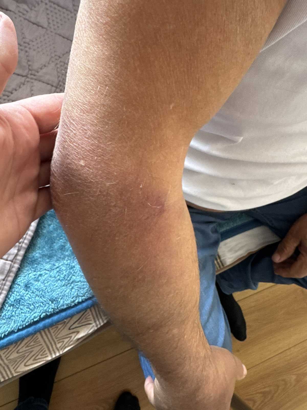 Policijska brutalnost, povrede