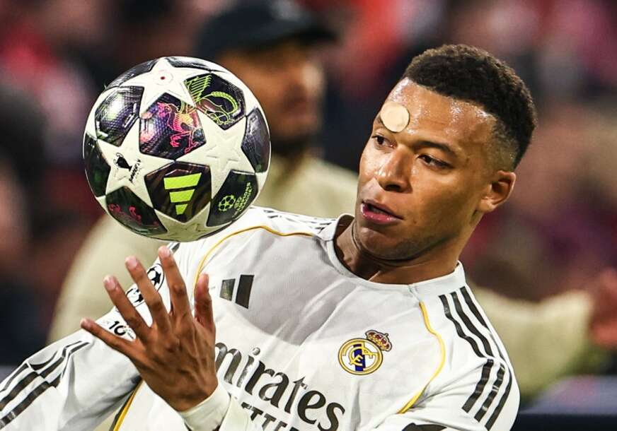 FOTO: ANNA SZILAGYI/EPA