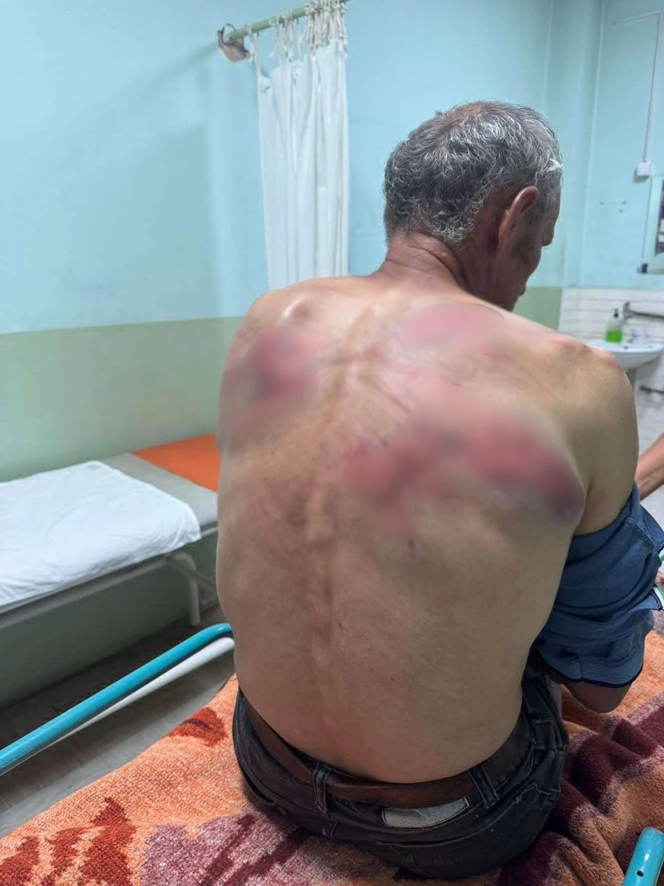 FOTO: USTUPLJENE FOTOGRAFIJE