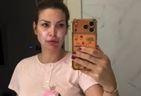 (VIDEO) "Pamtiću ovo dugo" Bivša voditeljka u suzama pokazala lice nakon požara kod njene vile u Vrdniku