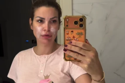 (VIDEO) "Pamtiću ovo dugo" Bivša voditeljka u suzama pokazala lice nakon požara kod njene vile u Vrdniku