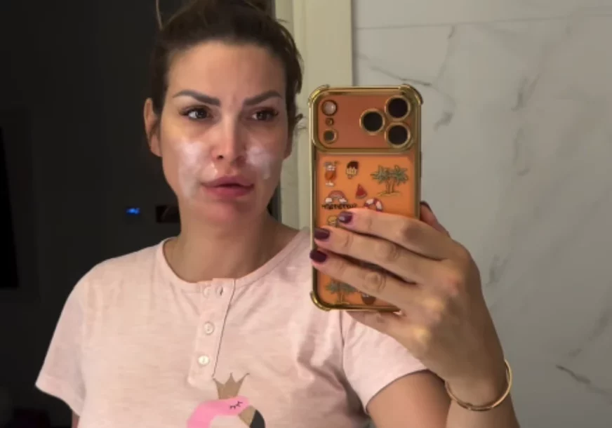 (VIDEO) "Pamtiću ovo dugo" Bivša voditeljka u suzama pokazala lice nakon požara kod njene vile u Vrdniku