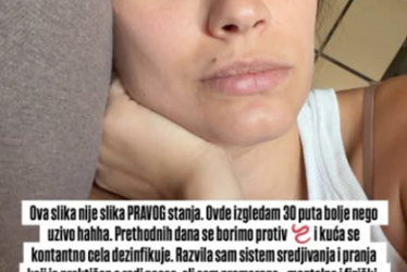 (FOTO) “Ovdje izgledam 30 puta bolje nego uživo” Trudna glumica prolazi kroz agoniju, bori se protiv glista