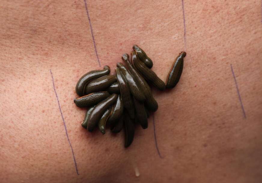 pijavice