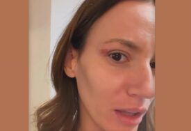 (FOTO) "MAMINI GENI" Kristina Spalević sva u ranama, pokazala modricu na licu