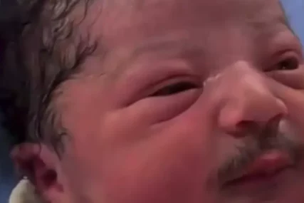 (VIDEO) BEBA ROĐENA SA BRKOVIMA I BRADOM Snimak iznenadio hiljade ljudi, a stručnjaci objasnili o čemu je riječ