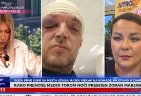 LICE PUNO PODLIVA Prva slika pretučenog Zorana Marjanovića, oko mu je skroz zatvoreno, glava u zavojima